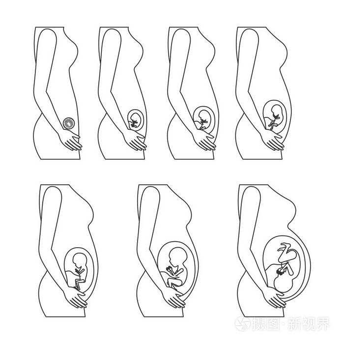 软骨发育不全怎么办,苏州代怀生子需要多少软骨发育不良可治愈吗